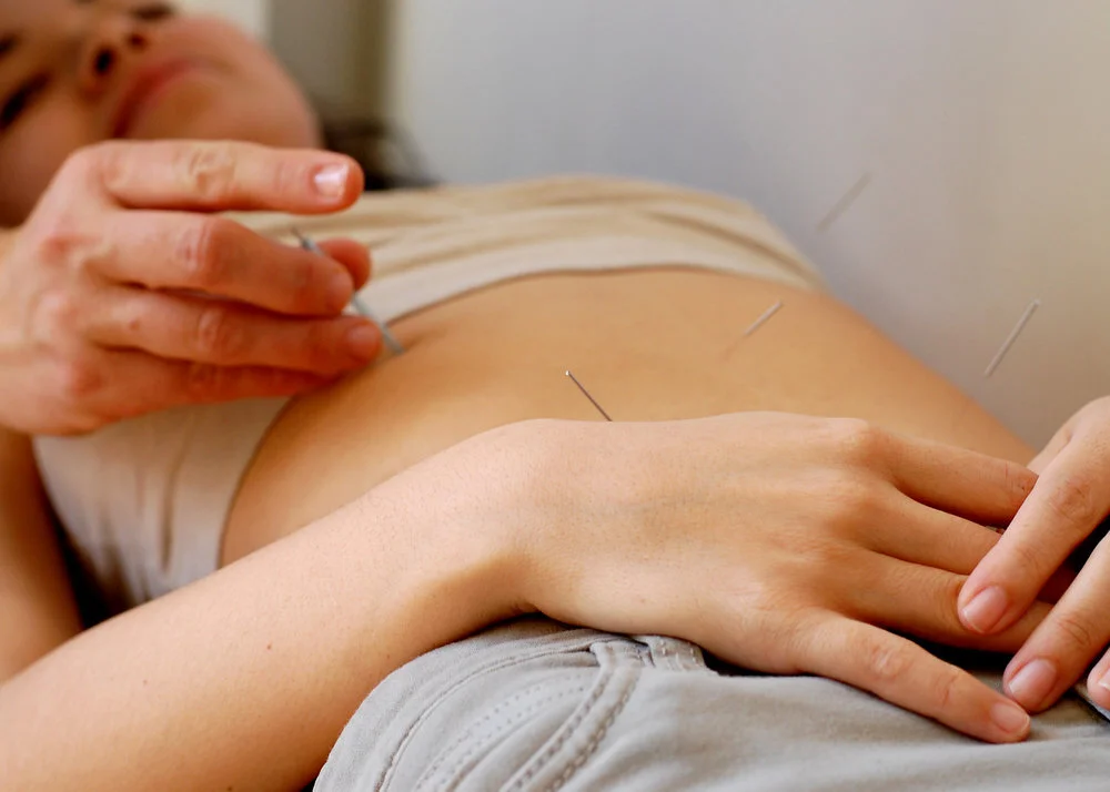 South Philly Community AcupunctureAcupuncture