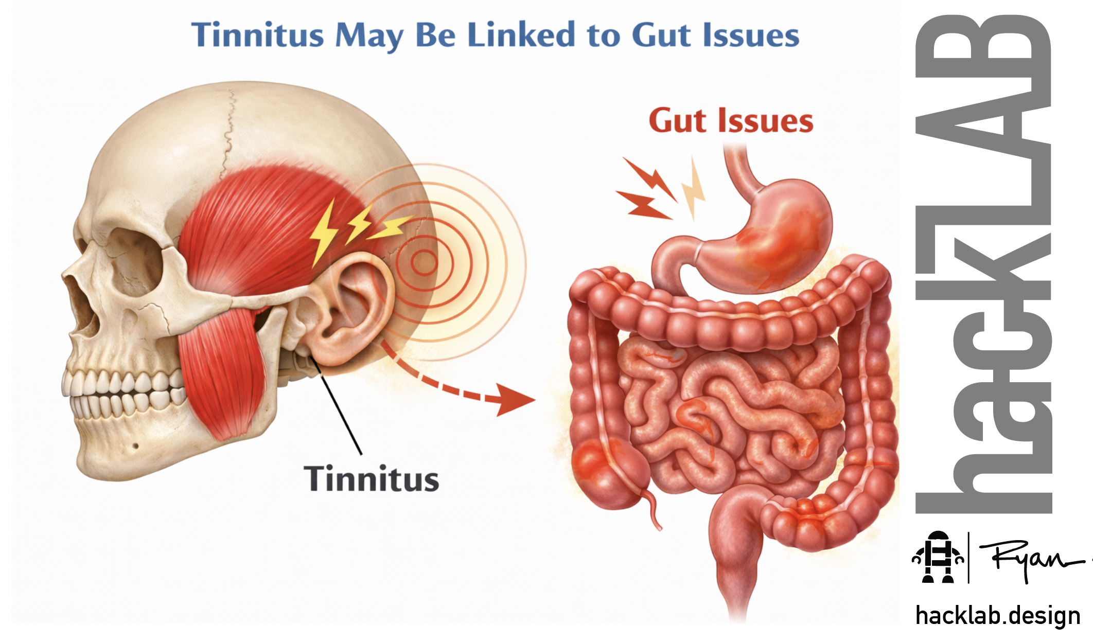Tinnitus and your stomach - Gut Brain Connection