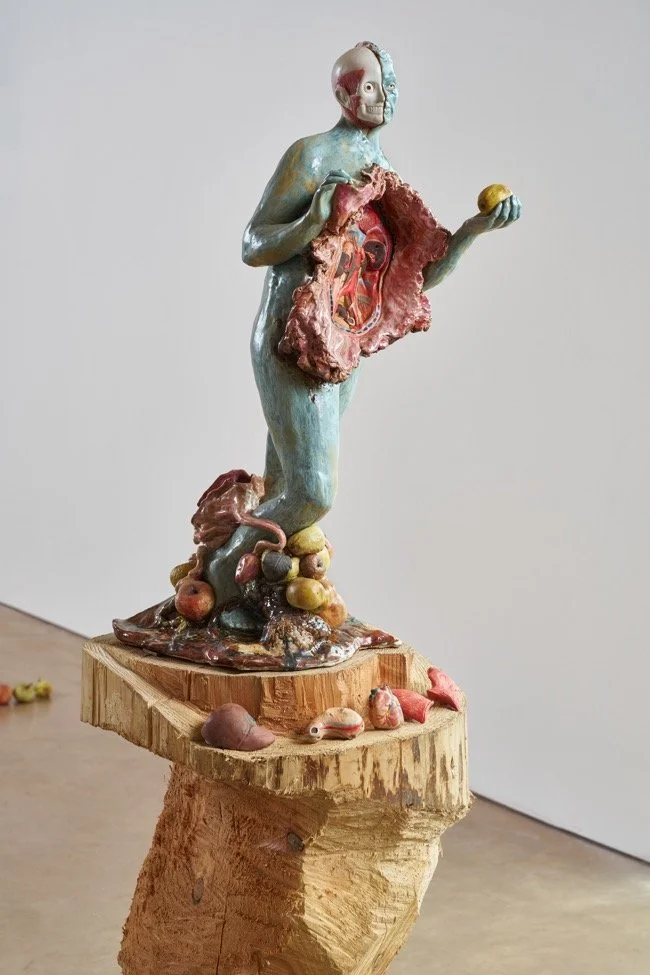  I was also responding to art-historical and medical representations of women, particularly the slashed Venuses used as diagnostic tools from the 18th century onwards. These figures perpetuated the male gaze, reducing women to opened, sexualised bodi