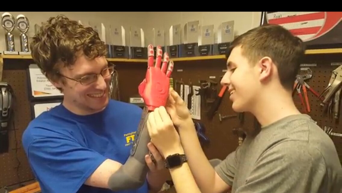 Building a Prosthetic Hand