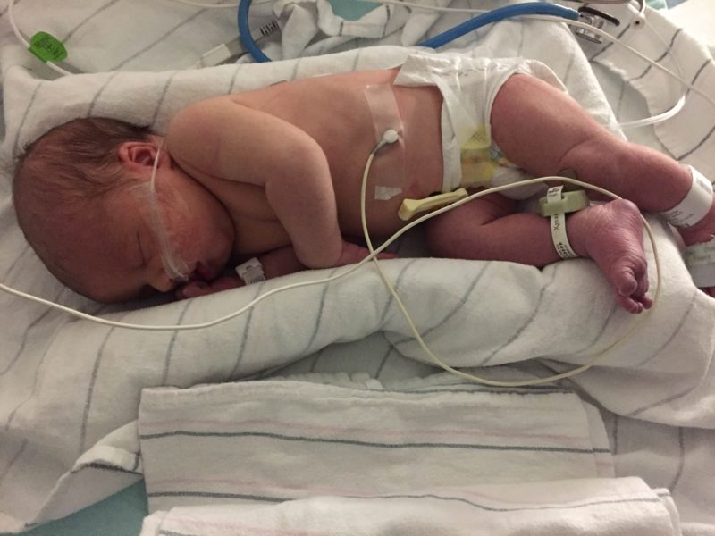 Jasper while in the NICU. Photo provided by Amber Lumpkin.