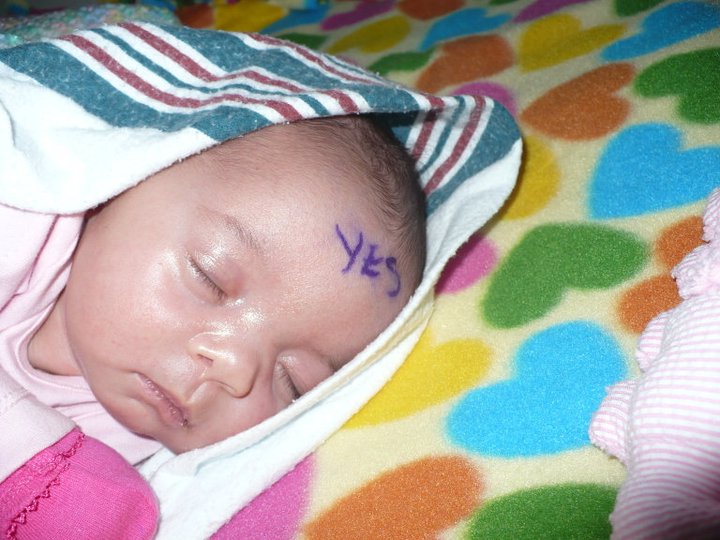 Maddy before her surgery
