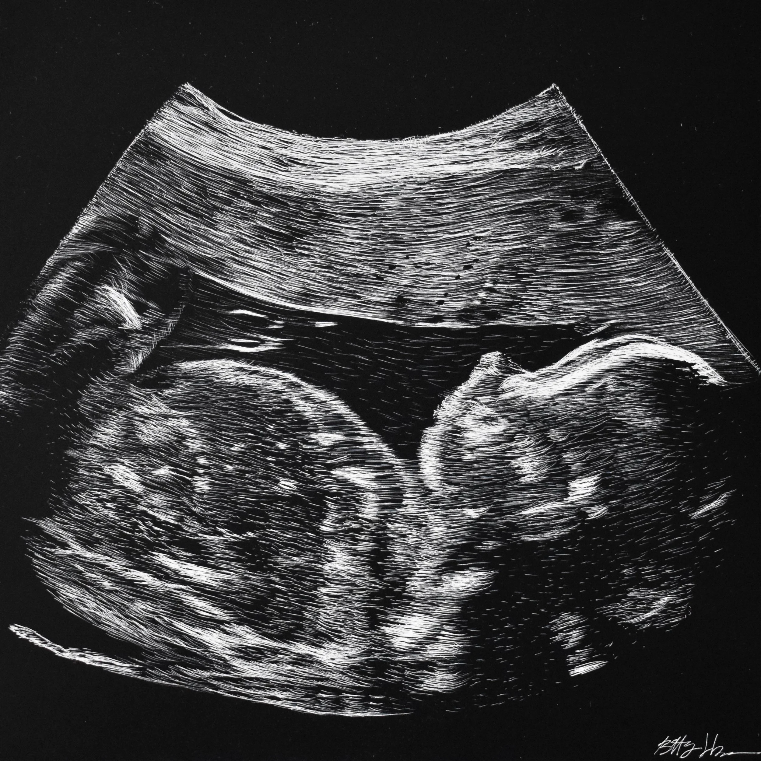 Sonograms