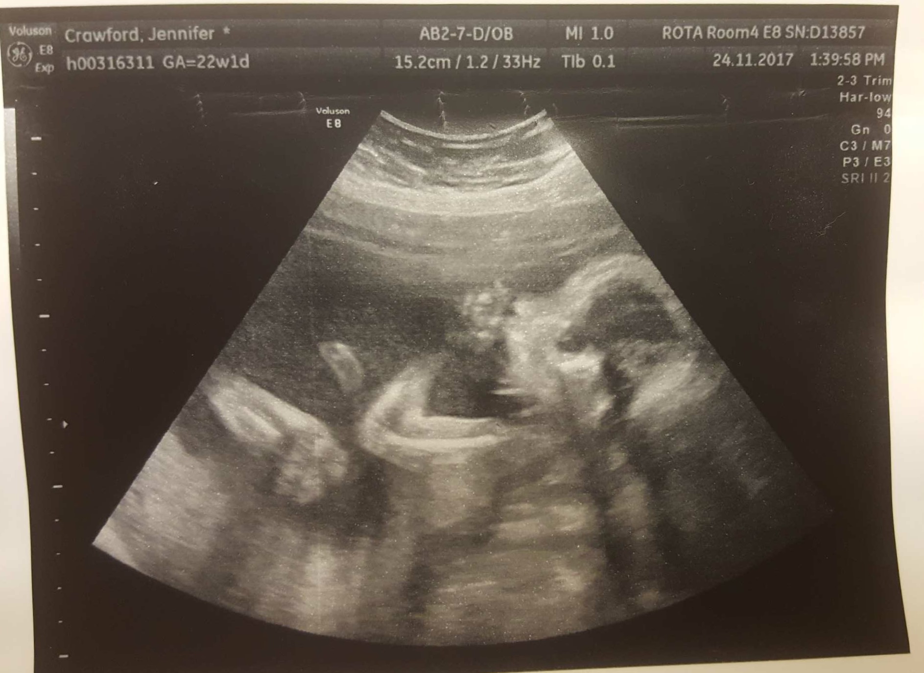 Our little girl at 21 weeks 