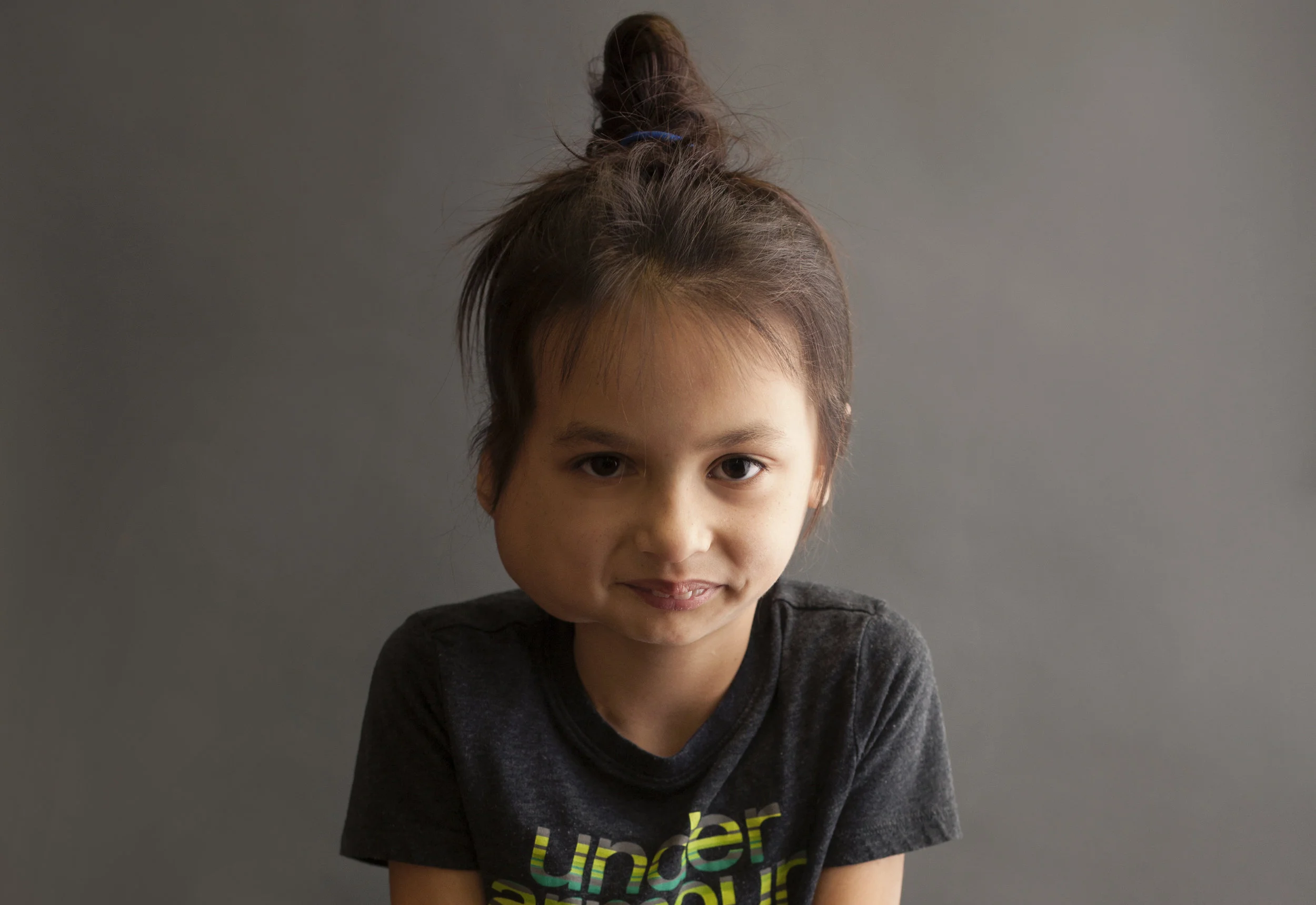 Diagnosed with an aggressive Fibromatosis, or Desmoid tumor, in her head and right mandible when she was 2; she's now 8 years old. This is a rare and hard to treat diagnosis. She has undergone multiple procedures related to this including chemotherapy and 3 major surgeries attempting to remove her tumor. Dani had this tumor removed last year and is thriving!