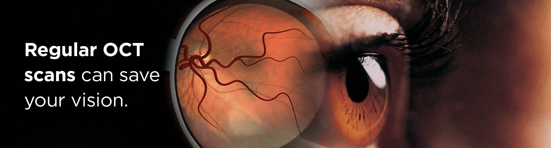macular-degeneration.jpg