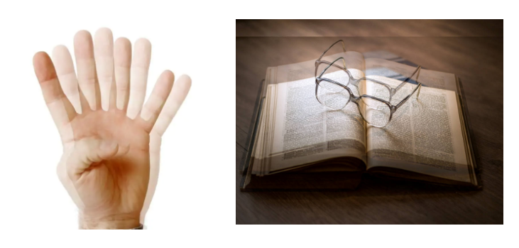 Double Vision (Diplopia): Causes, Symptoms & Treatment