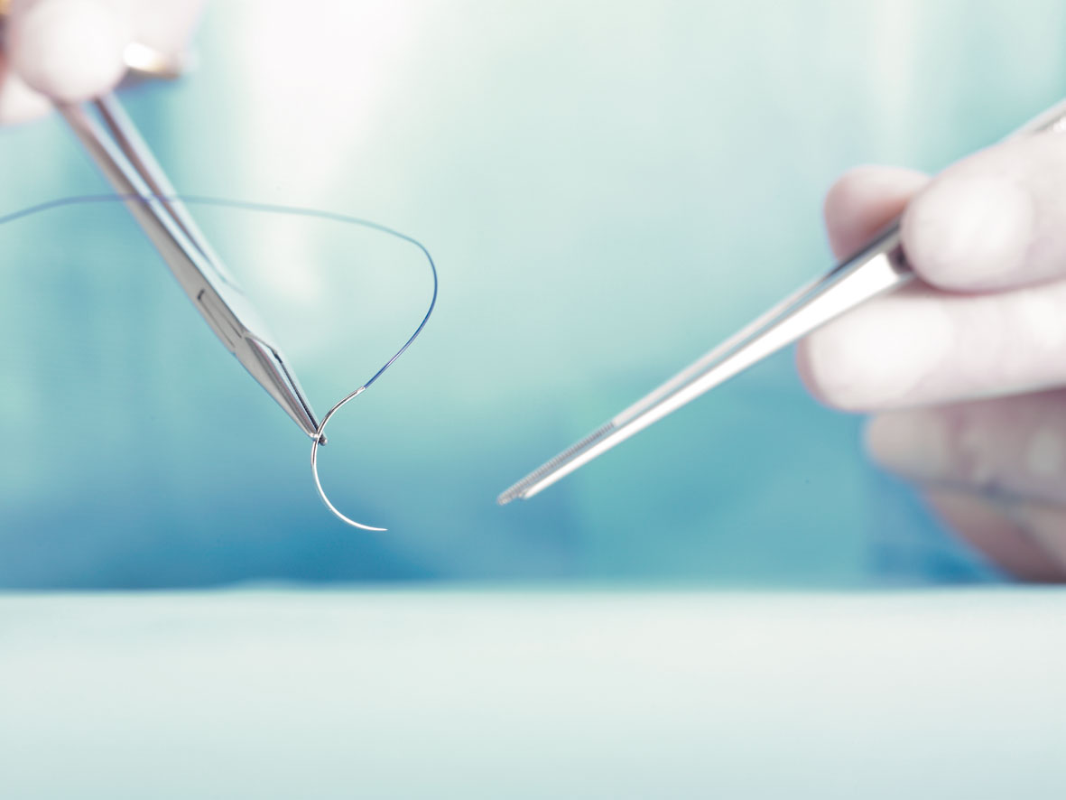 Sutures