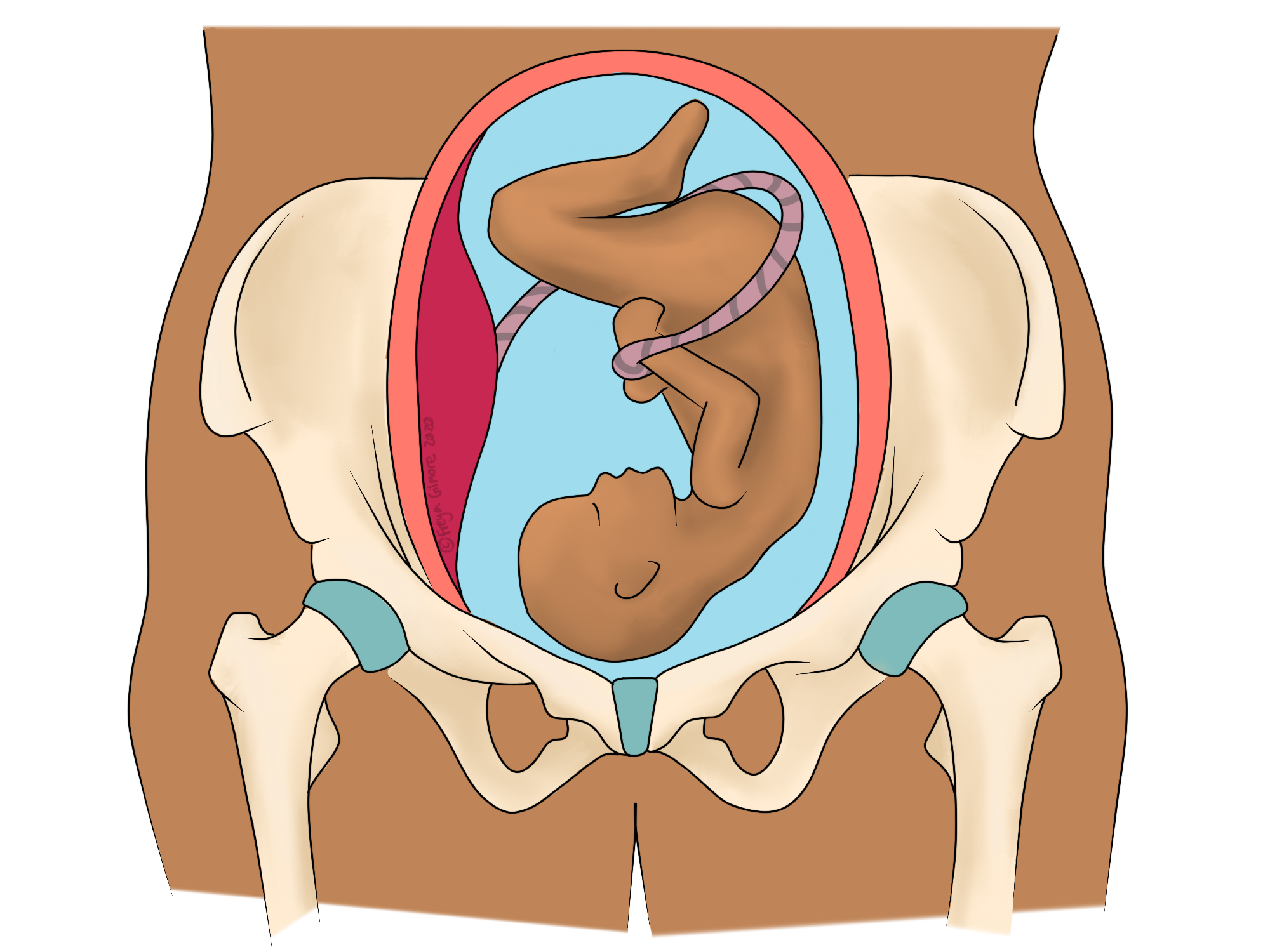 Pelvic Joint Pain in Pregnancy —, Naas Osteopaths