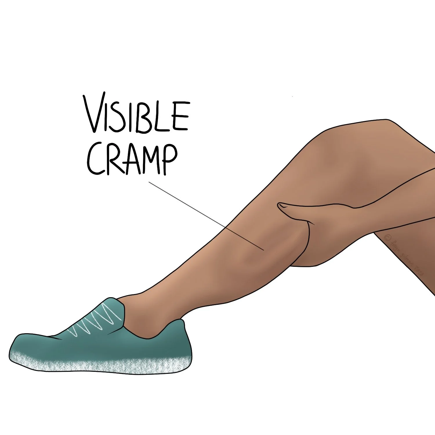 Cramps and Muscle Spasms