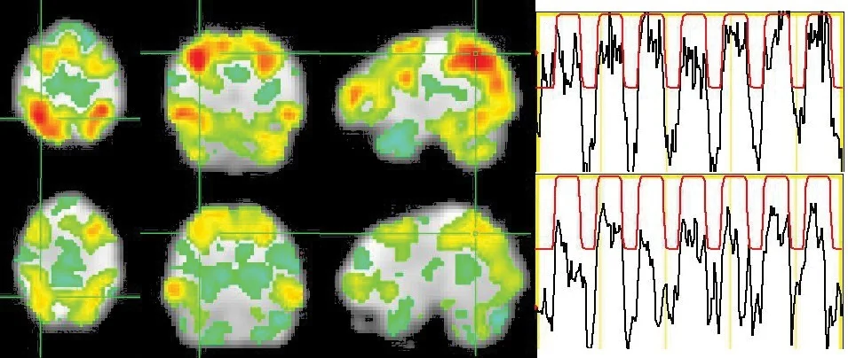 From the article in The Atlantic I liked to above: images on the left show the brain of a creative subject (top) and a matched control subject during a word‐association task.