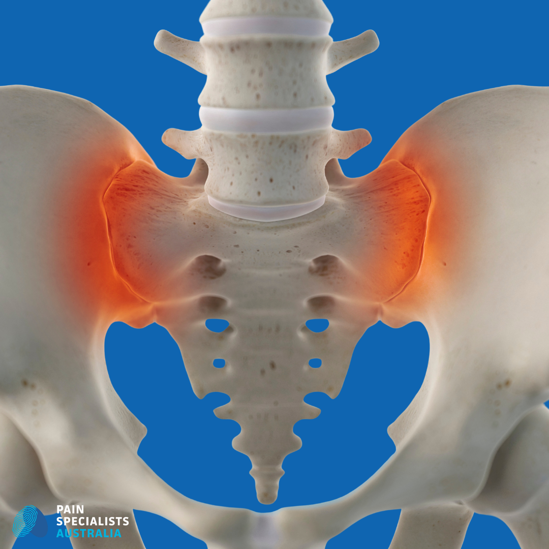 Sacroiliac Joint Pain Treatment In Melbourne Pain Specialists Australia Sacroiliac Joint Pain Treatment In Melbourne Pain Specialists Australia
