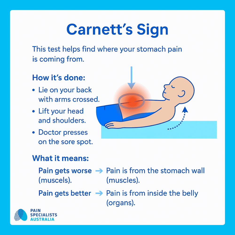 Carnett Sign Negative Stomach Pain Specialists Melbourne | Diagnosis & Treatment — Pain ...