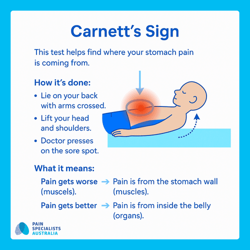 Carnett Sign Negative Stomach Pain Specialists Melbourne | Diagnosis & Treatment — Pain ...