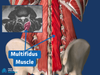 Multifidus Muscle Stimulation for Chronic Back Pain | Melbourne — Pain ...