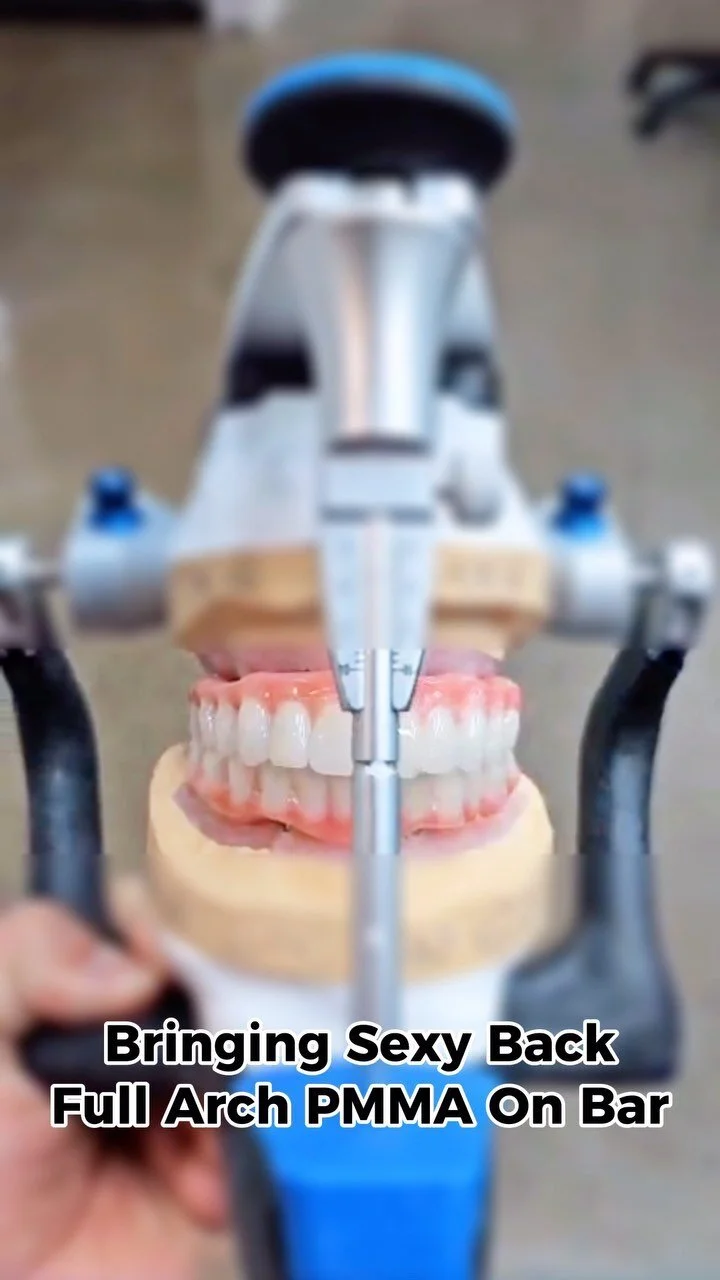 Innovative Fully Guided Implant Placement Solutions — Styledent High