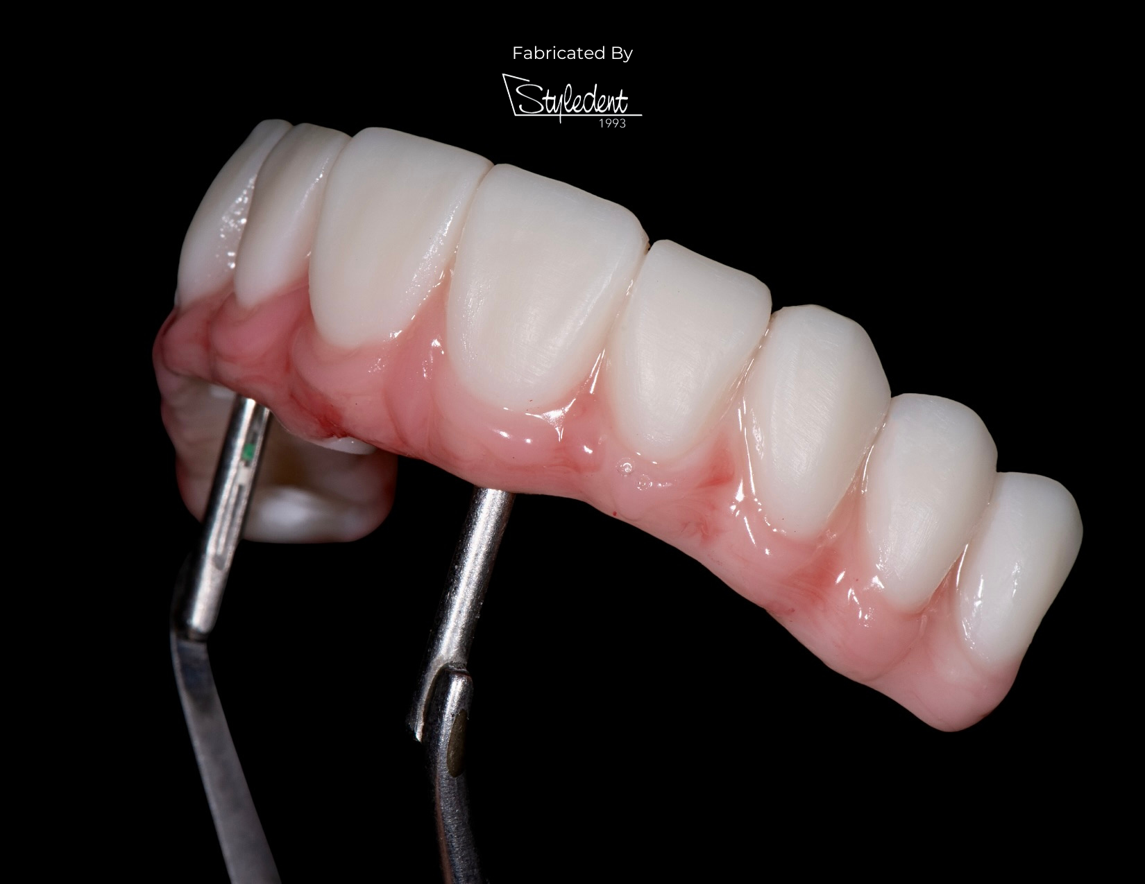 All-on-X Implant Treatment: Exploring the Benefits