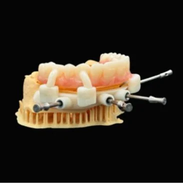 Enhance Your Implant Procedures with Our Guided Surgery Solutions