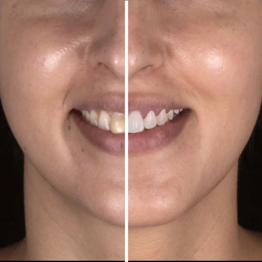 A Guide To Digital Smile Design 