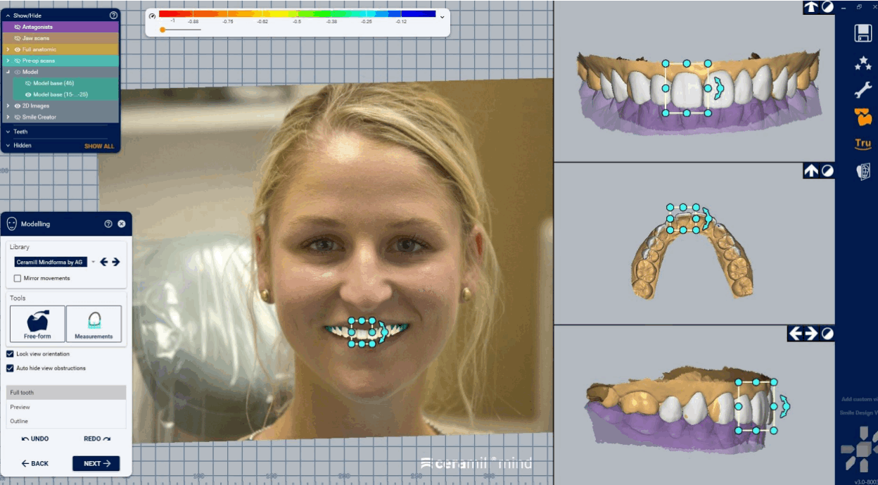 Digilog-Styledent Digital Dental Lab
