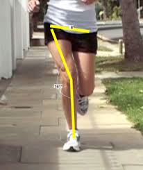 knee valgus.png