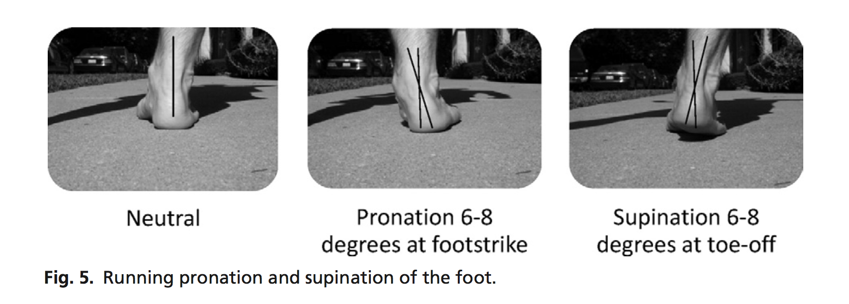 Pronation is NORMAL- however not coming out of pronation, or too much of it is problematic 