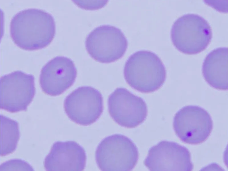 “Cytauxzoonosis.” CAPC Vet , 20 Feb. 1AD, www.capcvet.org/guidelines/cytauxzoonosis/.