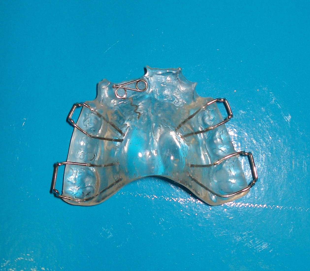 Single arch Removable Appliance 