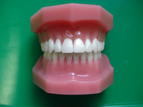Double arch Incognito Lingual Braces mounted on a plastic model but the lingual braces are not visible because they are fitted behind the teeth.