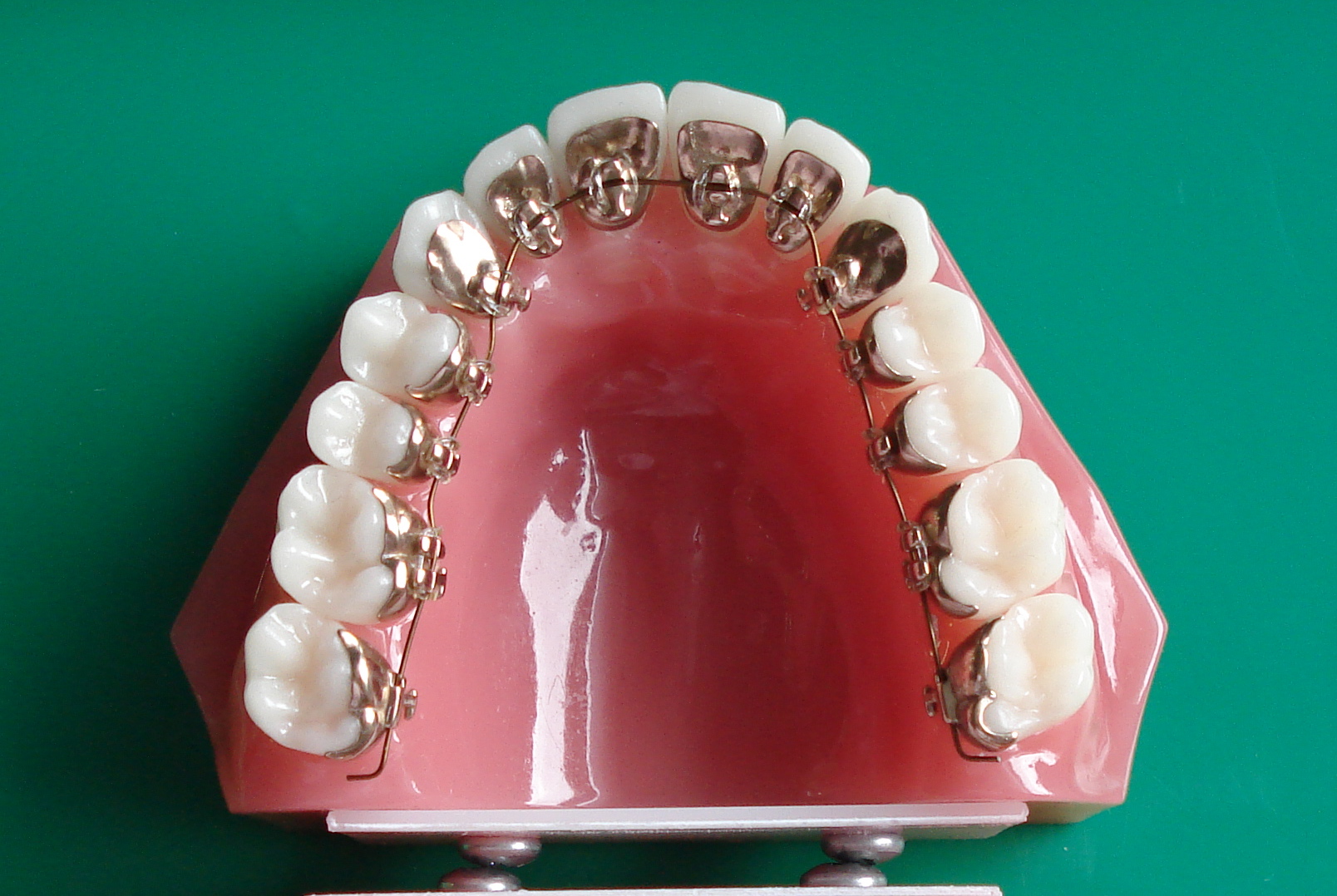 Closeup of a single arch Incognito Lingual Braces mounted on a plastic teeth..
