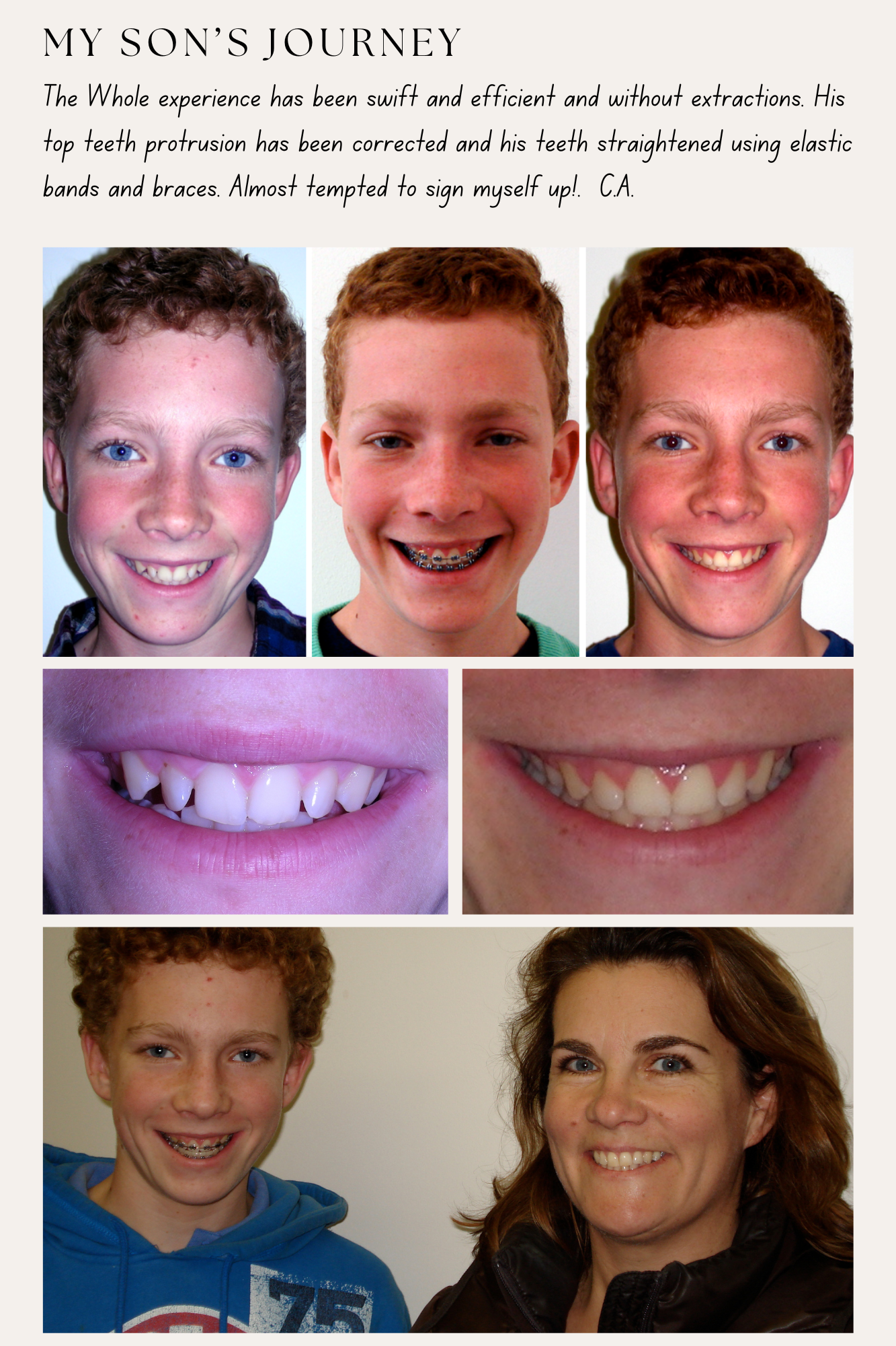 Before treatment, with metal braces on, after treatment and with parent photos of a male teenager patient plus a written testimonial. 