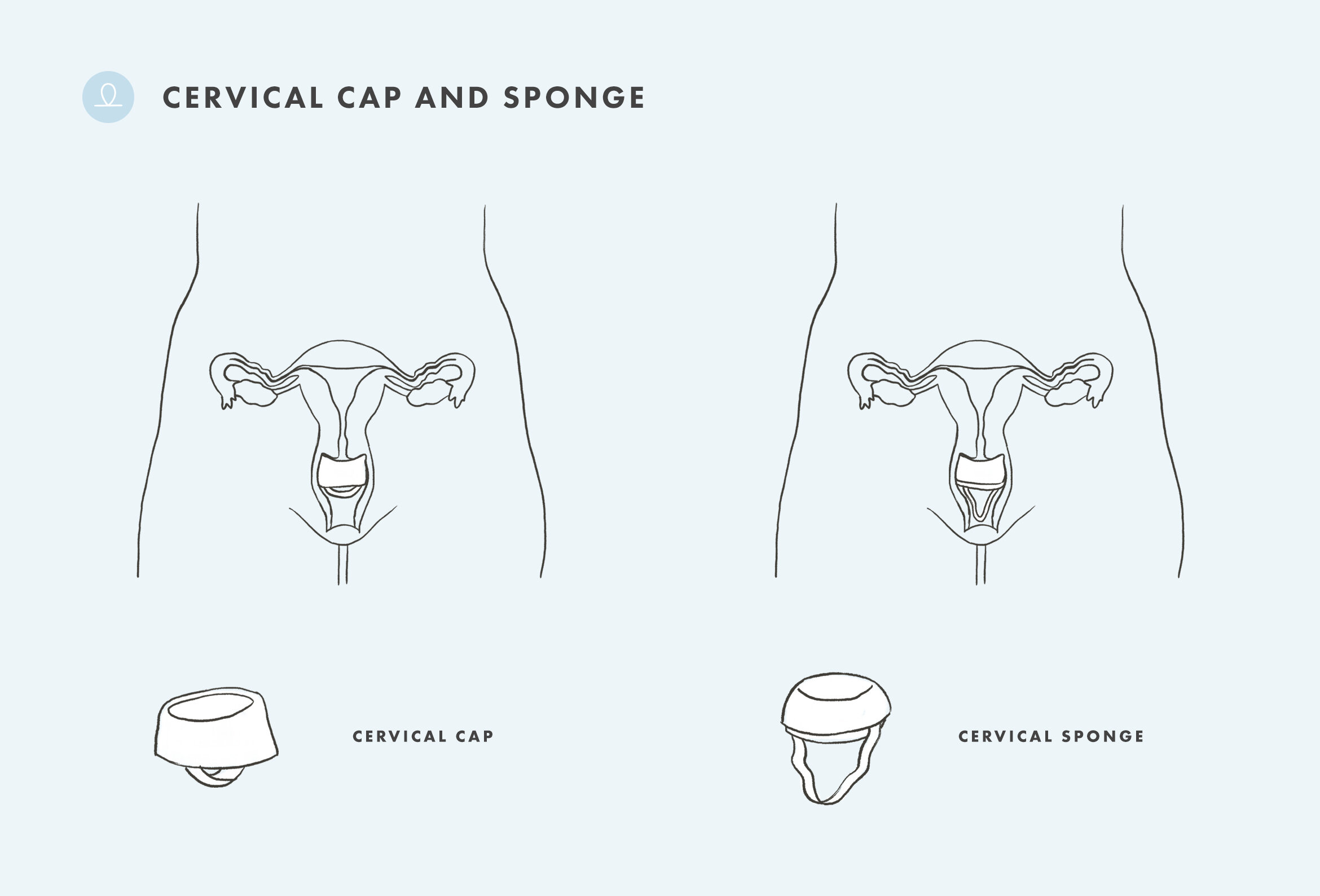 Evve-The Contraception Series-Cervical Cap and Sponge page-diagram 1102 @2x.jpg