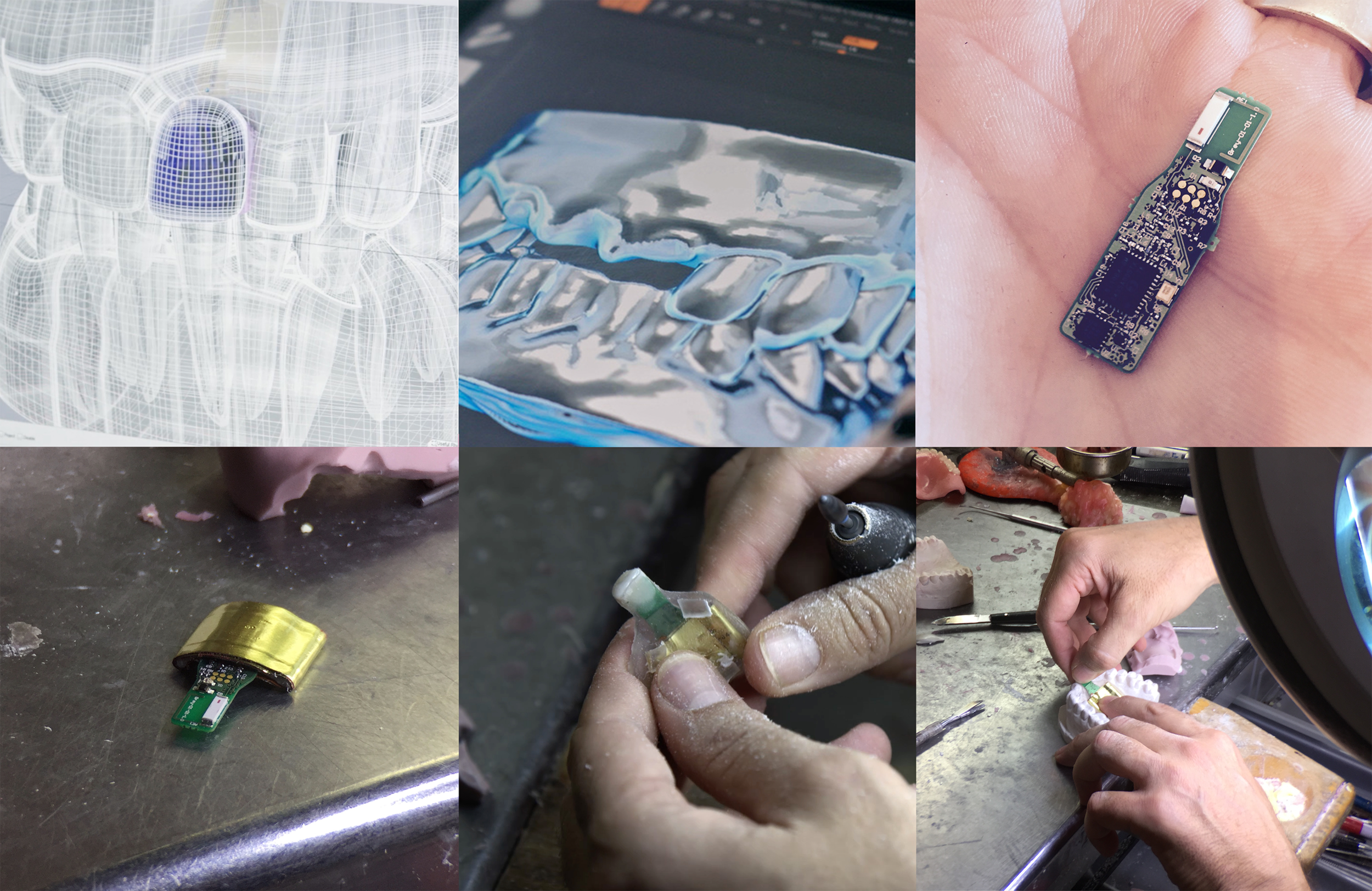 ST making of tooth images.png