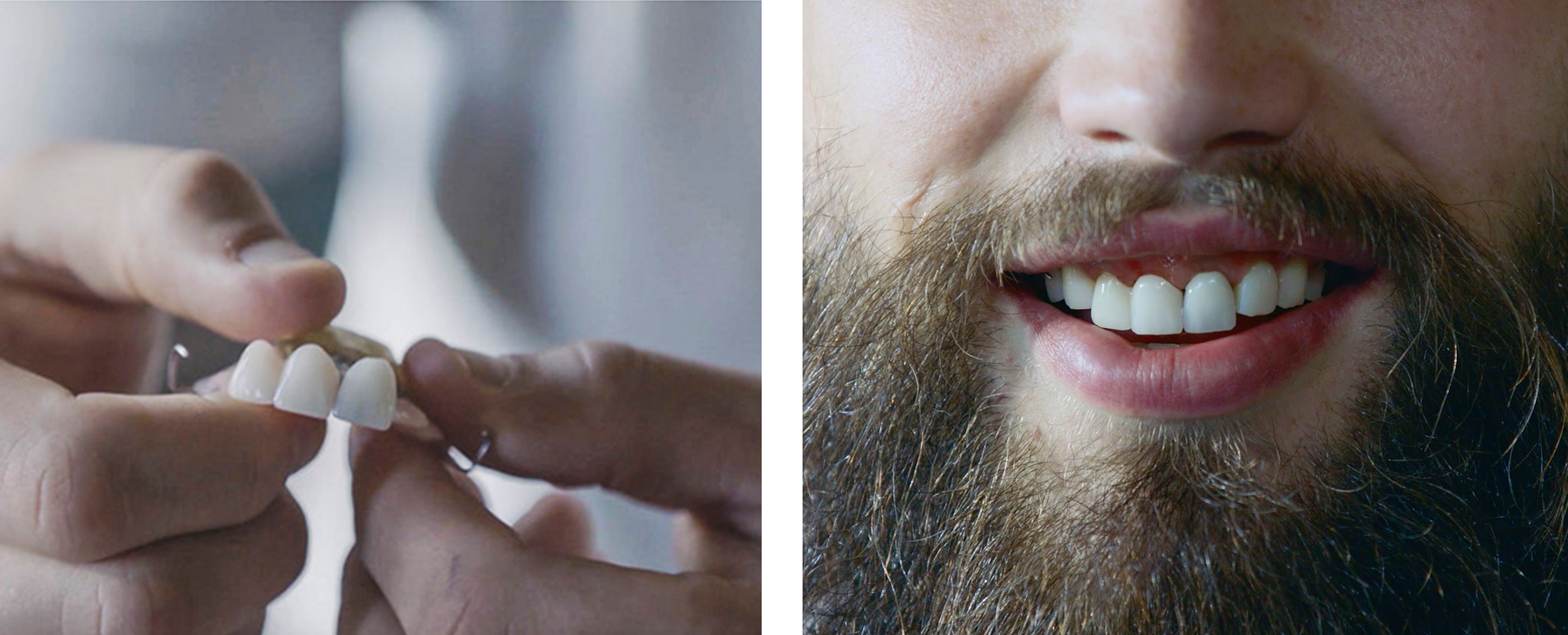 ST testing tooth image.png