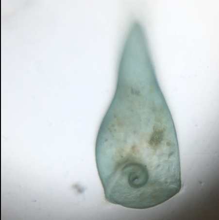 Stentor Coeruleus 2.png