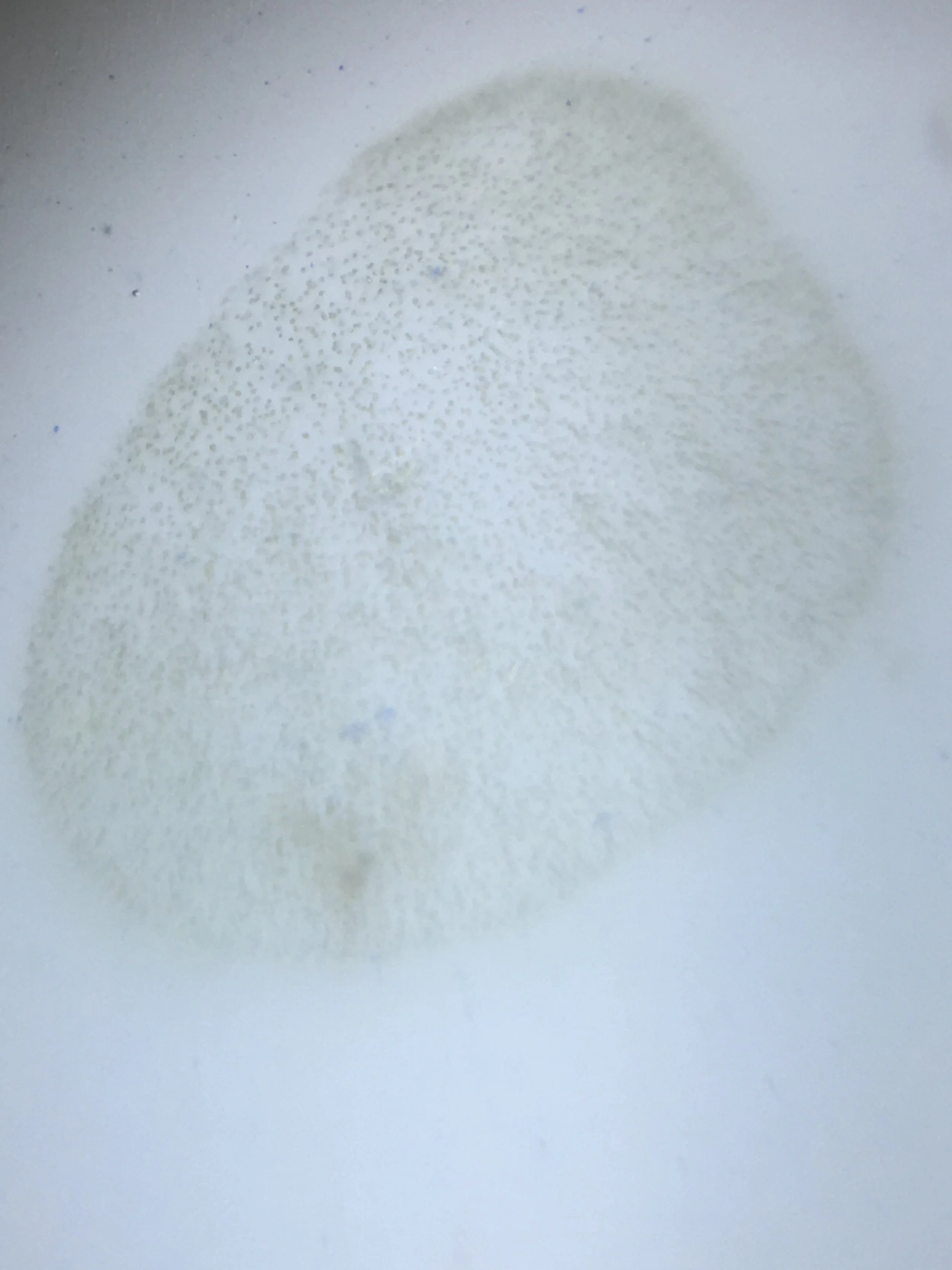Bacterial Pattern.jpg