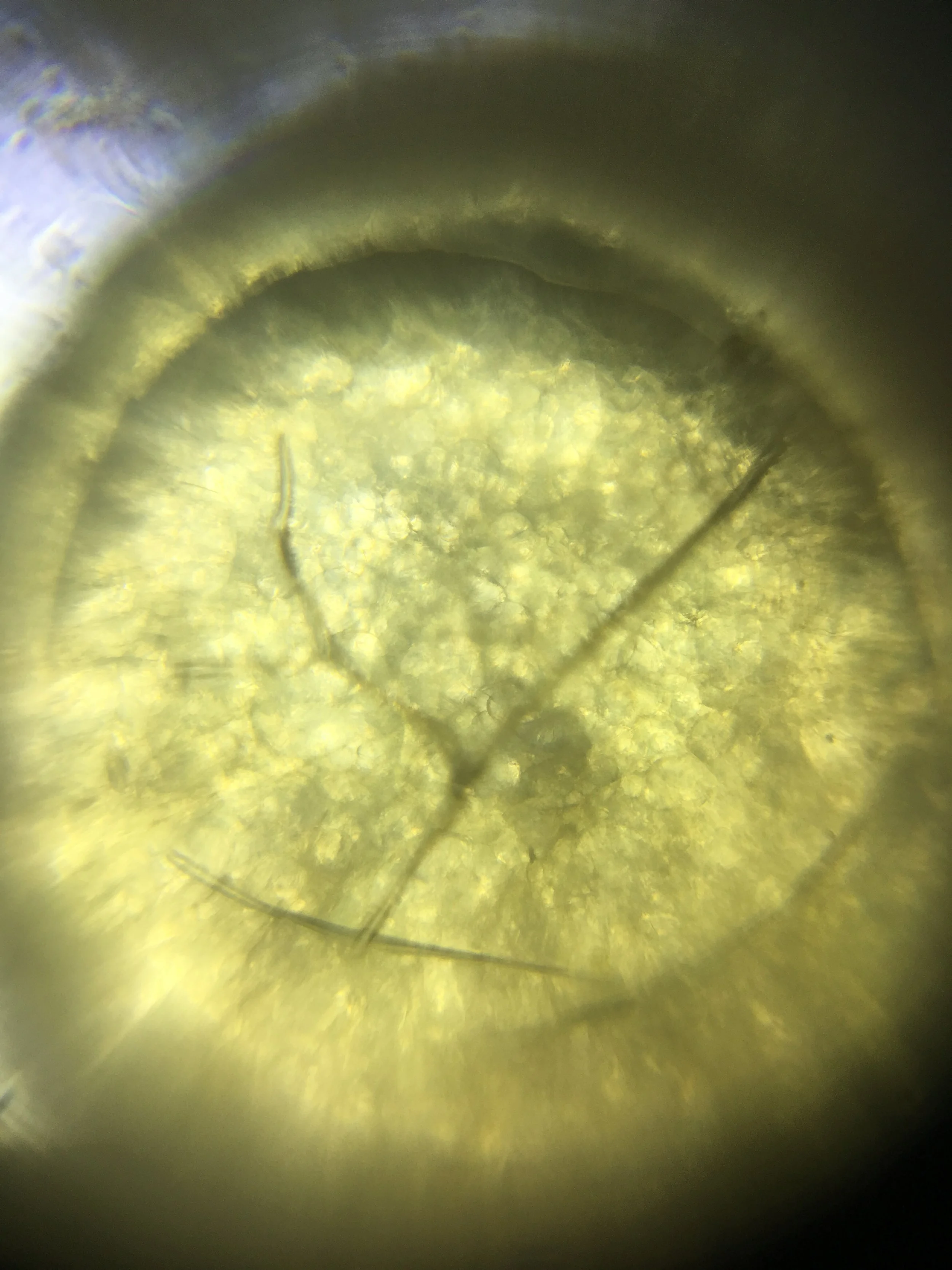 Centipede egg.jpg