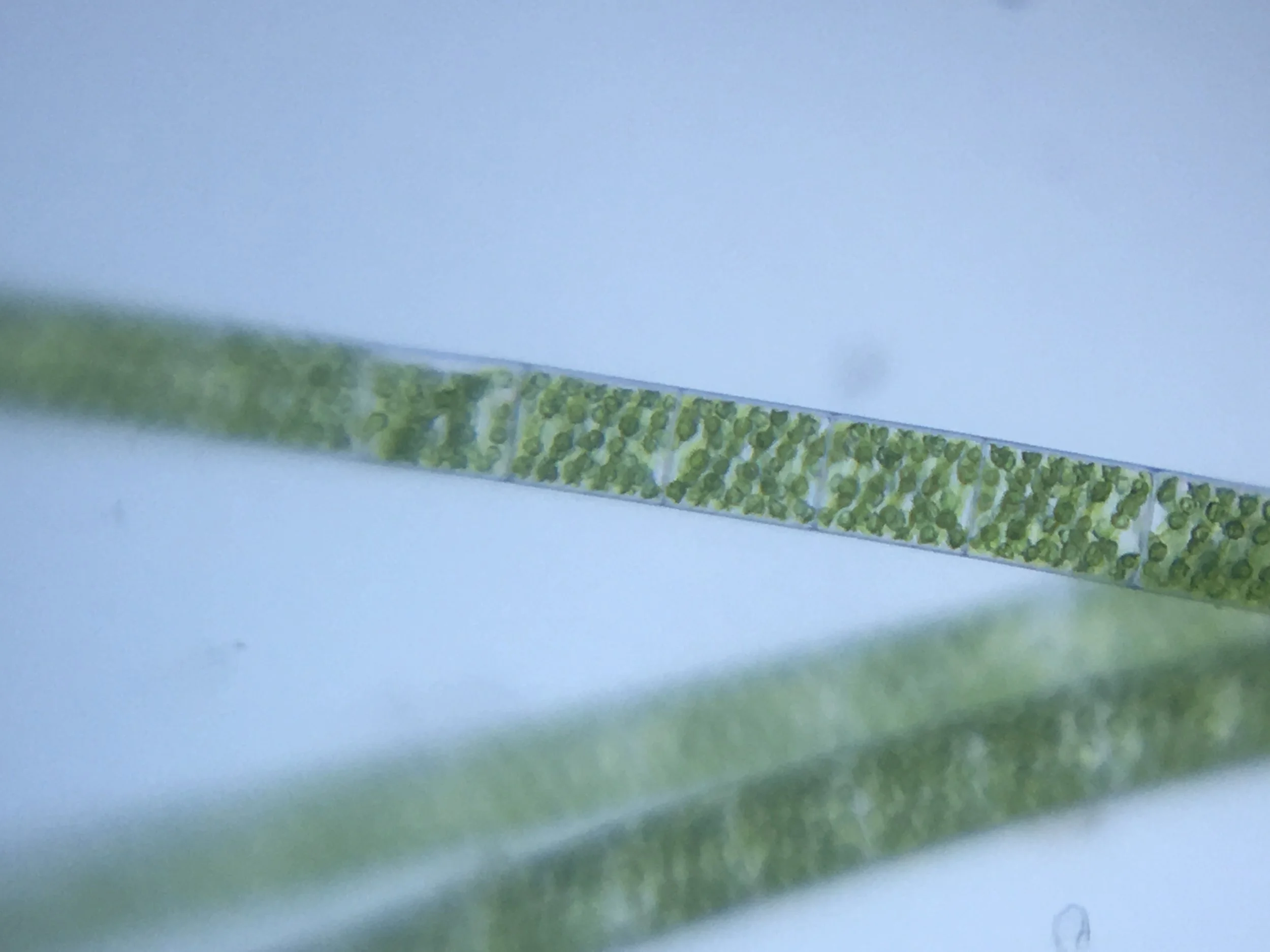 Spirogyra 4.jpg