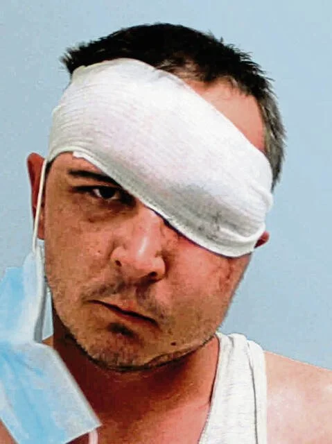 Westmoreland County pays $150K to settle inmate lawsuit over claims of guard attack