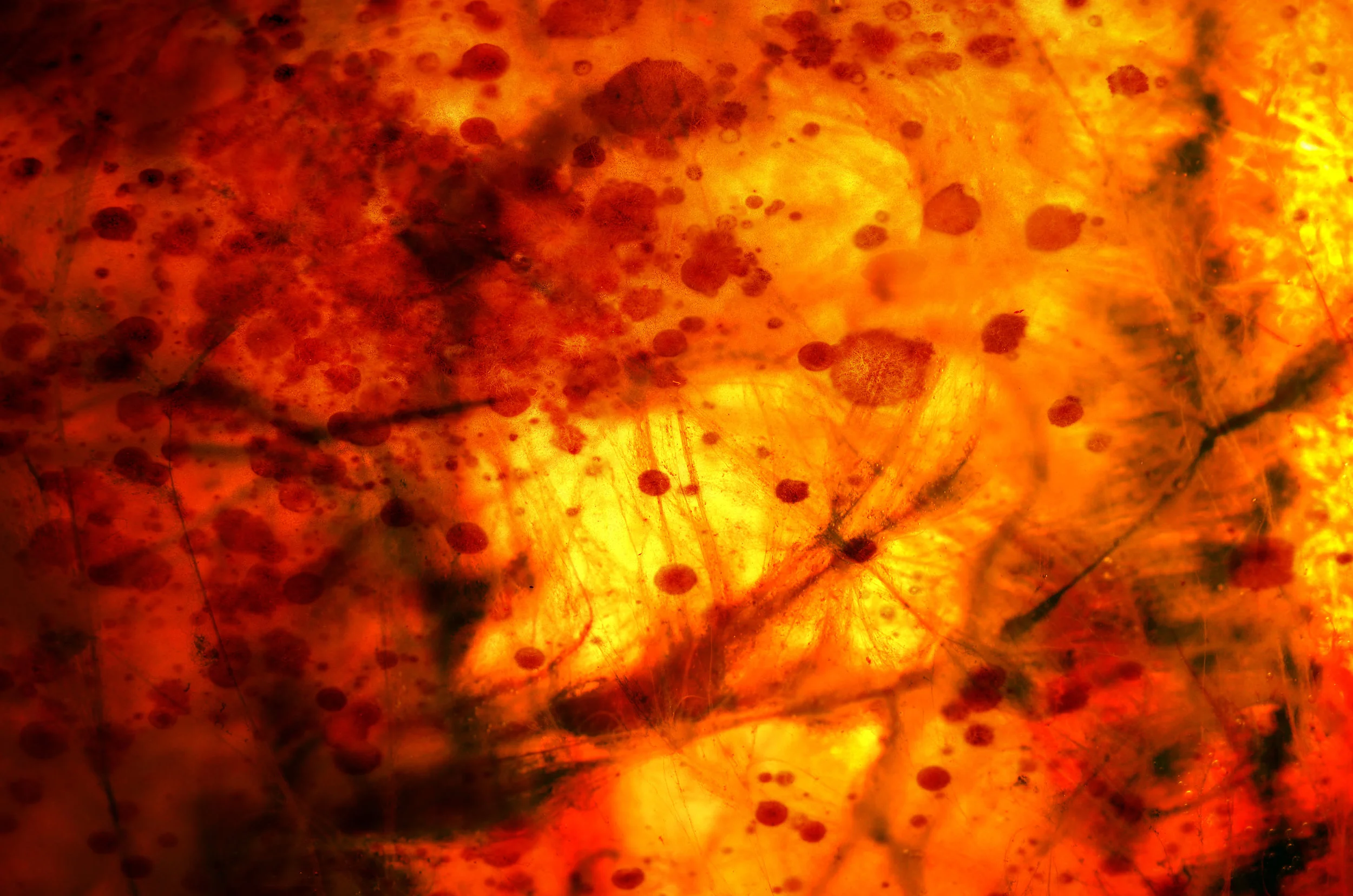 Why Is Candida So Complicated?