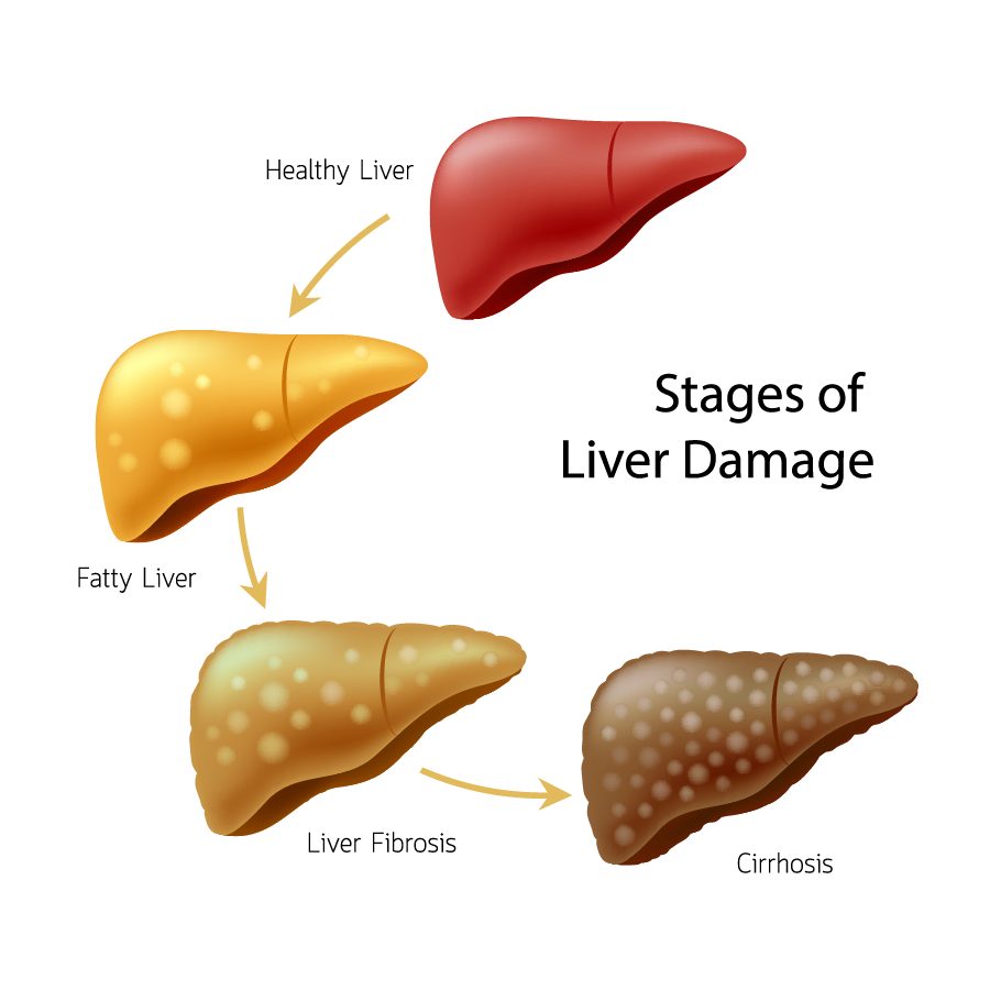 Why There Is A Vitamin D Deficiency Epidemic Back To