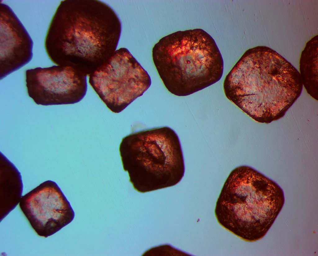 What Does It Mean If You Have High Sodium Levels?