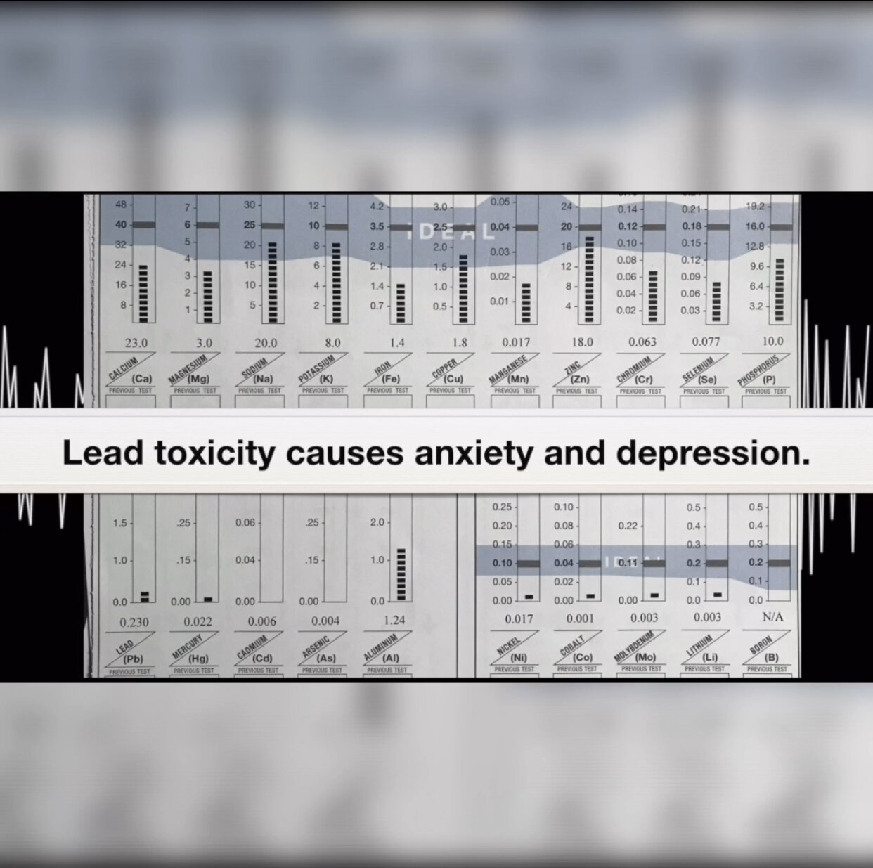 Lead Toxicity And The Four Lows Pattern | Case Study With Dr. Robert Selig