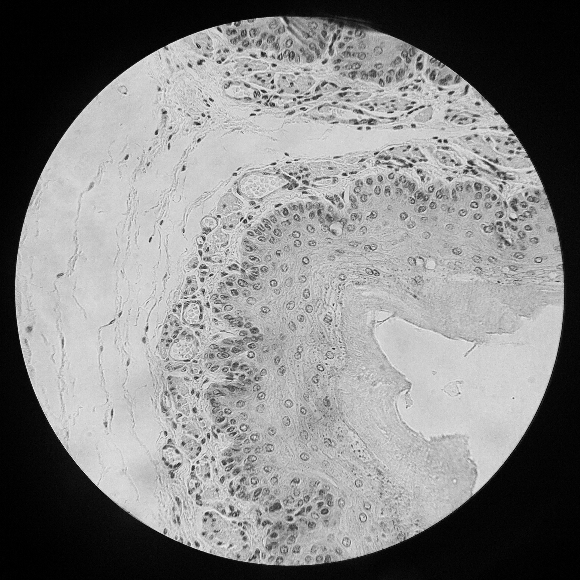 Epithelial (Skin) Tissue-- Topographic Layers, Coastal Cliffs and Erosion