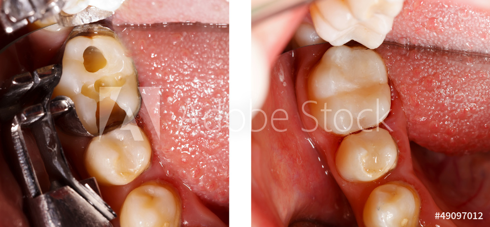 AdobeStock_49097012_Preview.jpeg