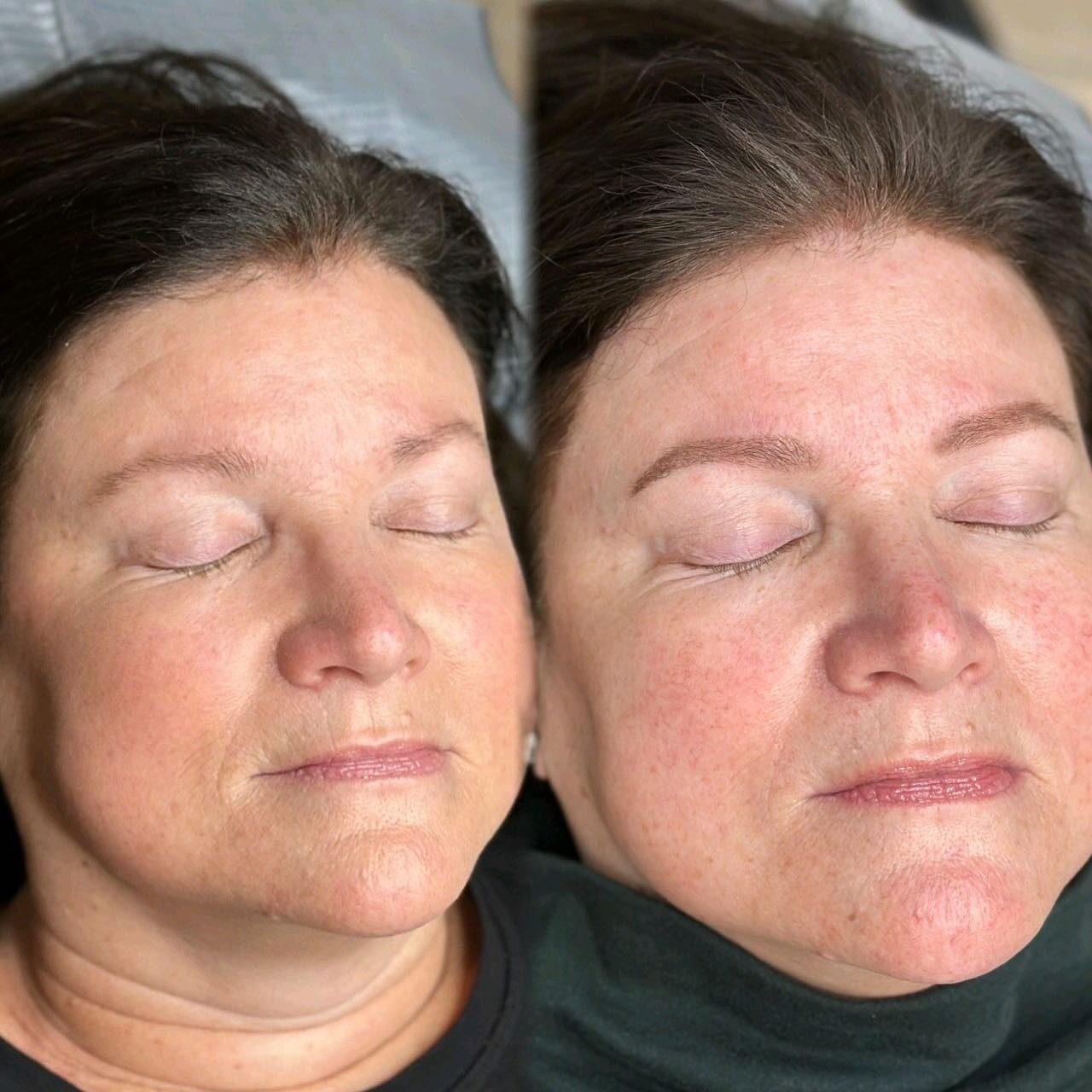 Healed soft powder brow cosmetic tattoo. She has no make up on in both photos but look at how the right photo makes her look more enhanced now that she has permanent brows.