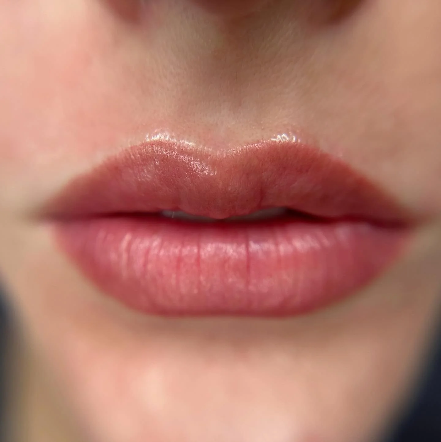 💋👄💋👄💋👄