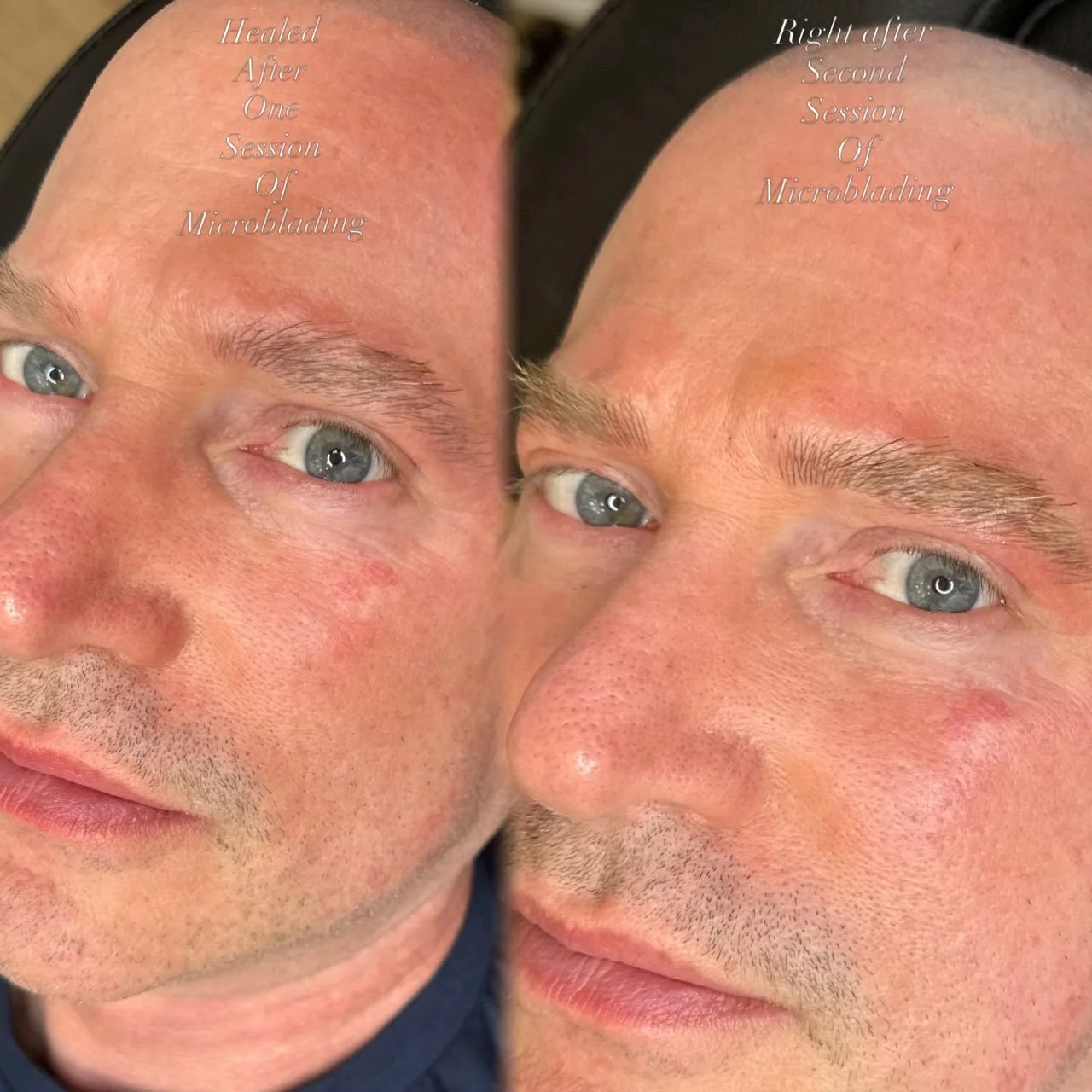 Of course I forgot to take a before picture. This client wanted to go very very slowly with what we added. He did not want anyone to notice that he got anything done to his brows but wanted a small enhancement to them. These will fade a tiny little b