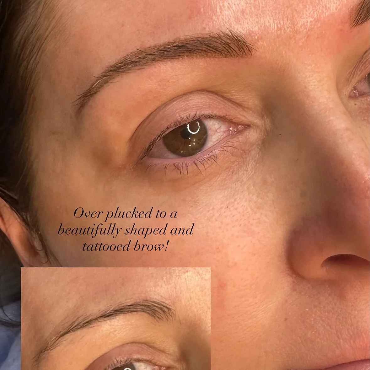 I see this shape far too often. Overplucked and the hair doesn&rsquo;t seem to grow back. A cosmetic tattoo is your best bet if you want a more structured shape for your face.