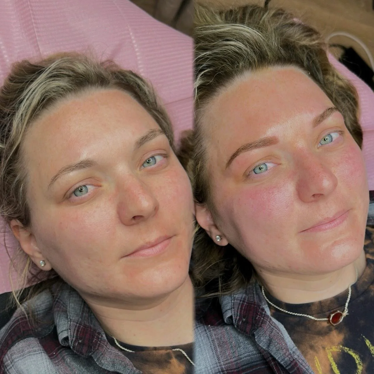 This pretty woman starts chemotherapy in 2 weeks. Unfortunately she will lose all of her beautiful hair and eyebrows. I had the pleasure of helping her out by adding some pigment into the skin before that happens. She will have a soft shaded eyebrow 